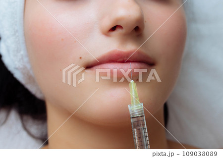 sensual female lips, procedure lip augmentation. Syringe near womans mouth, injections for increase lips shape 109038089