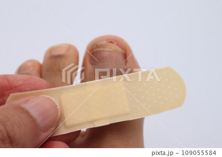 怪我をした足と絆創膏 109055584
