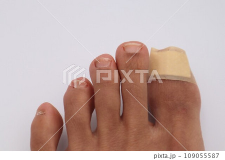 絆創膏を貼った足の指 109055587