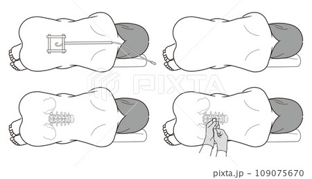 硬膜外麻酔・くも膜下麻酔・無痛分娩のイラスト 109075670