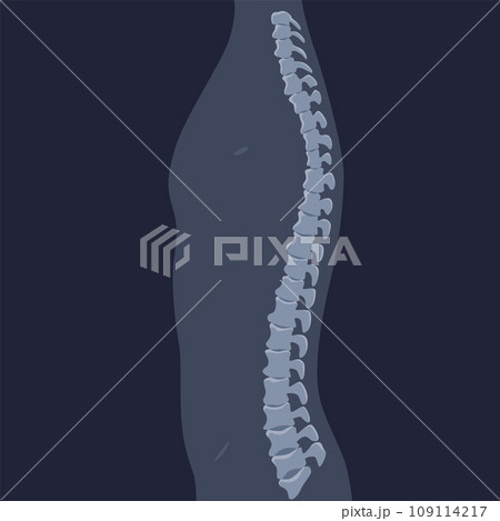 Human bones orthopedic and skeleton icon, bone x-ray image of human joints, anatomy skeleton flat design vector illustration 109114217