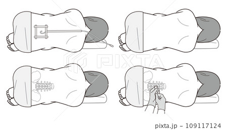 硬膜外麻酔・くも膜下麻酔・無痛分娩・帝王切開・麻酔・注射・麻酔科医・イラスト 109117124