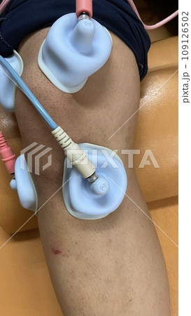 干渉波を整骨院で受ける男性 干渉波を整骨院で受ける男性 109126502