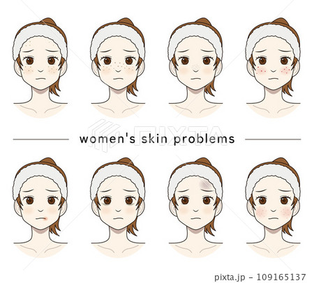 肌トラブルに悩む女性のイラスト 肌トラブルに悩む女性のイラスト 109165137