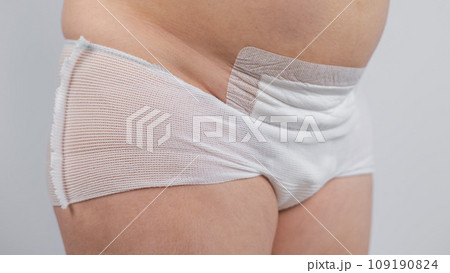 Close-up of a woman's belly after a caesarean section. A mother who recently gave birth. Close-up of a woman's belly after a caesarean section. A mother who recently gave birth. 109190824