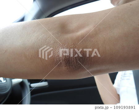 男性の肘 肘 ひじ 男性のスキンケア 肌 男性の肘 肘 ひじ 男性のスキンケア 肌 109193891