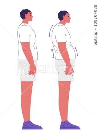 Boy with good and bad posture 109204088