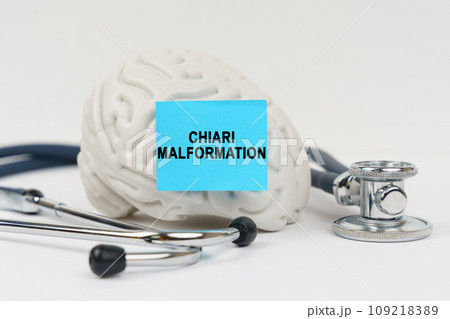 On a white surface next to the stethoscope lies a brain on which a sticker with the inscription - Chiari malformation 109218389