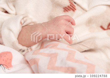 【新生児の赤ちゃん　手の皮が剥ける】 109224788