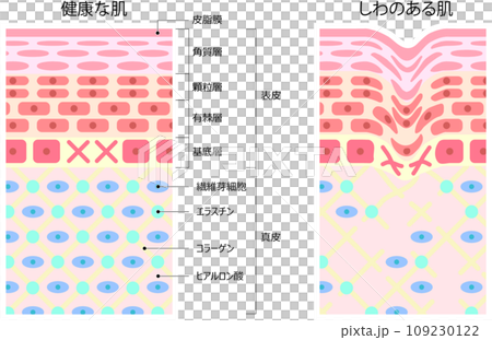 Cross section of healthy skin and wrinkled skin Cross section of healthy skin and wrinkled skin 109230122