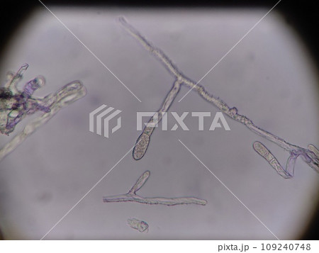 カビの分生子ができる過程 109240748