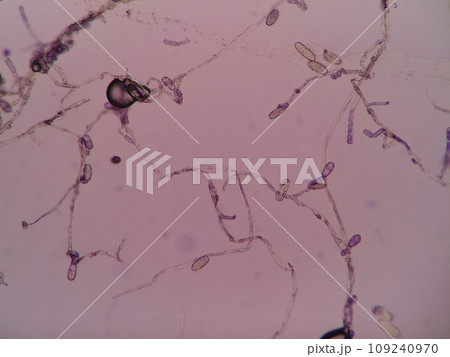 カビの菌糸と分生子 109240970