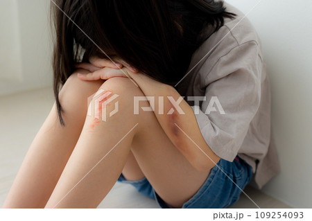 子供怪我イメージ（傷は特殊メイクです）　 109254093