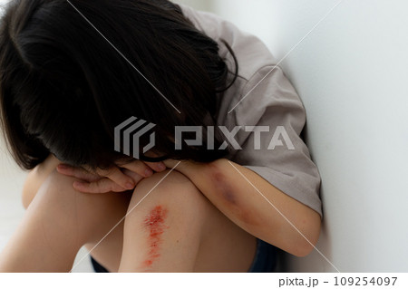 子供怪我イメージ（傷は特殊メイクです）　 109254097