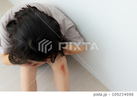 子供怪我イメージ（傷は特殊メイクです）　 109254098