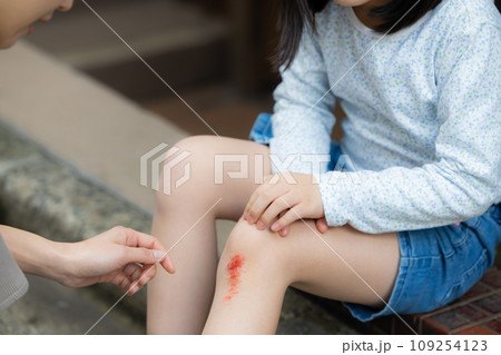 子供怪我イメージ（傷は特殊メイクです）　　 109254123