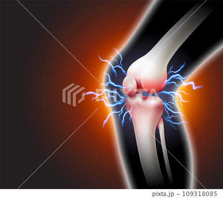 Knee pain and pain throbbing into the bone 109318085