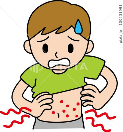 虫さされ・湿疹の症状 お腹 虫さされ・湿疹の症状 お腹 109331991