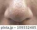 お肌の悩み 角栓の詰まったいちご鼻 109332485