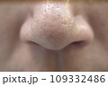 お肌の悩み 角栓の詰まったいちご鼻 109332486