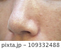 お肌の悩み 角栓の詰まったいちご鼻 109332488
