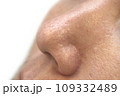 お肌の悩み 角栓の詰まったいちご鼻 109332489