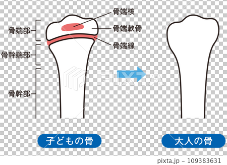 骨骺線 兒童骨骼與成人骨骼 骨骼生長 109383631