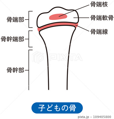 骨端線 子どもの骨 骨の成長 骨端線 子どもの骨 骨の成長 109405800