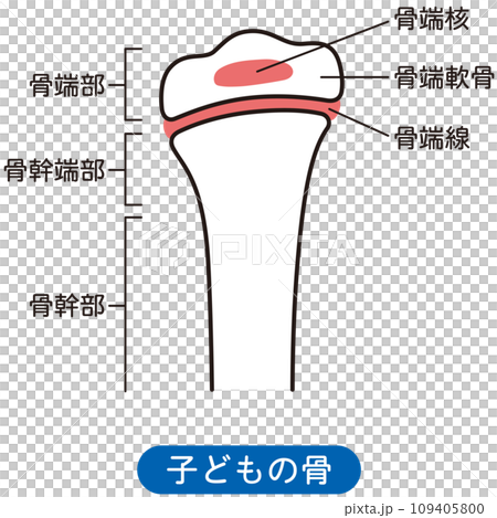 Epiphyseal line Children's bones Bone growth Epiphyseal line Children's bones Bone growth 109405800