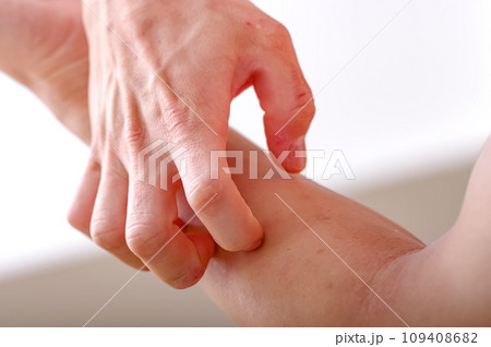 腕をかきむしる男性 109408682