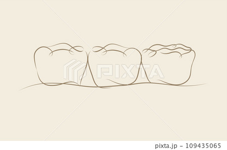 Implanted teeth with crown bridge beige color Implanted teeth with crown bridge beige color 109435065