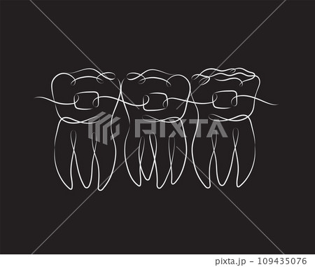 Teeth with braces black color Teeth with braces black color 109435076