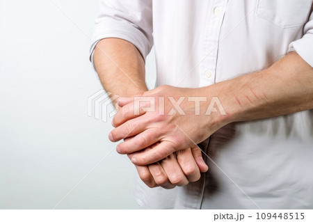 Skin diseases-allergies, psoriasis,diseases symptoms concept, Generative AI 109448515