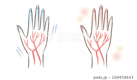 末端冷え性　血流の悪い冷えた指先と温かい指先のイラスト 109458643