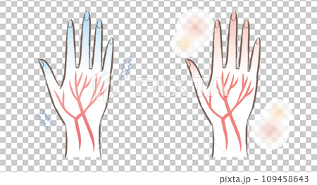 末端冷え性　血流の悪い冷えた指先と温かい指先のイラスト 109458643