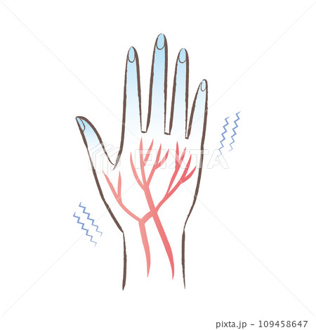 末端冷え性　血流の悪い冷たい手・指先のイラスト 109458647