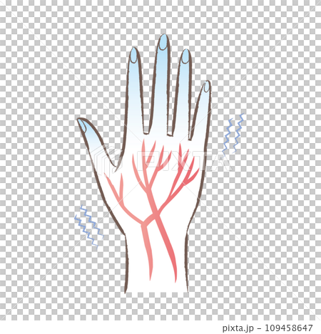 末端冷え性　血流の悪い冷たい手・指先のイラスト 109458647