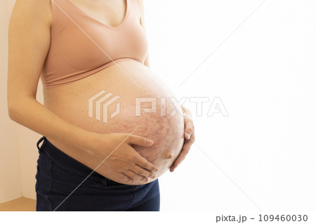 妊娠線と正中線があるお腹に手をあてる臨月の女性 妊娠線と正中線があるお腹に手をあてる臨月の女性 109460030