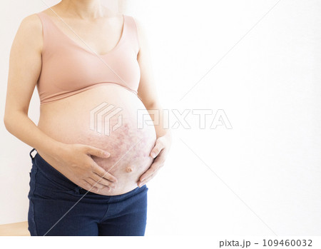 妊娠線と正中線があるお腹に手をあてる臨月の女性 109460032