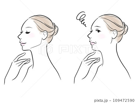 フェイスラインの変化　ビフォーアフター 109472590