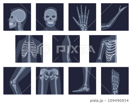 Human bones orthopedic and skeleton icon set, bone x-ray image of human joints, anatomy skeleton flat design vector illustration 109490854