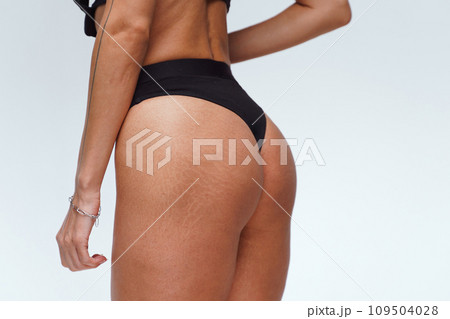 A woman with a beautiful feminine figure in black lingerie with overweight, cellulite and stretch marks. A woman with a beautiful feminine figure in black lingerie with overweight, cellulite and stretch marks. 109504028