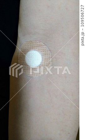 採血後の絆創膏を貼った腕 採血後の絆創膏を貼った腕 109506727