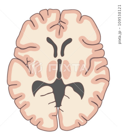脳の水平断面 109538121