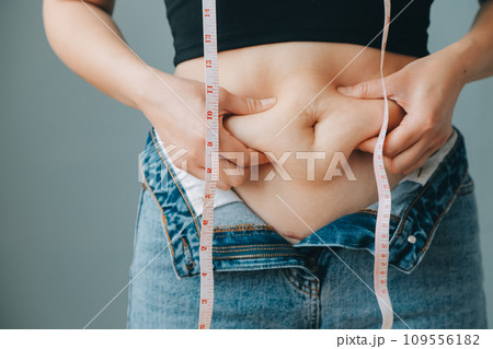 Close up of a belly with scar from c-section and abdominal fat. Women's health. A woman dressed up in sportswear demonstrating her imperfect body after a childbirth with nursery on the background. 109556182
