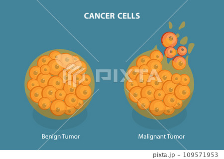 3D Isometric Flat Vector Illustration of Cancer Cells 109571953