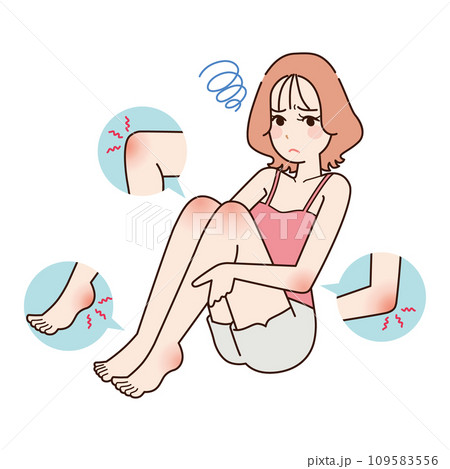 ひじ・ひざ・かかとのかさつき　女性 109583556