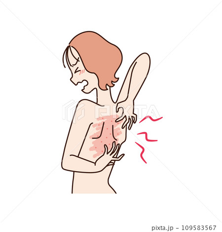 背中のかゆみ 女性 背中のかゆみ 女性 109583567