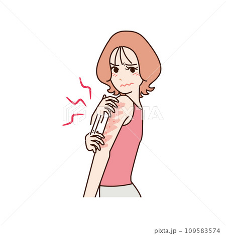 皮膚がかゆい　女性 109583574
