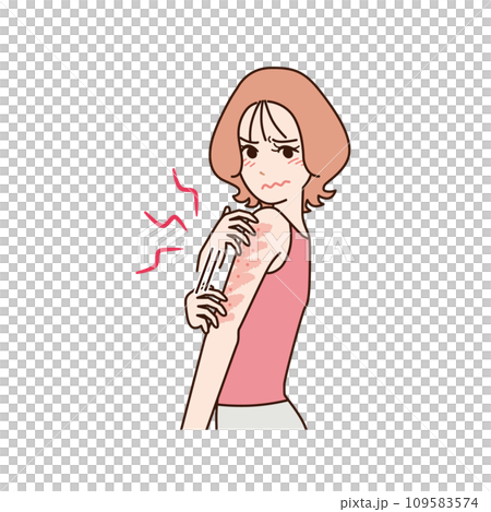 皮膚發癢的女人 109583574